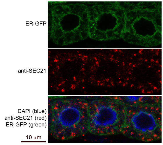 immunofluorescence using anti-Sec21 antibodies